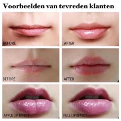 BenjaBeauty Lip Plumper - Lippen - Lipstick - Lippenbalsem - Rood - Wit -Cosmetica Korting Winkel 1200x1200 779