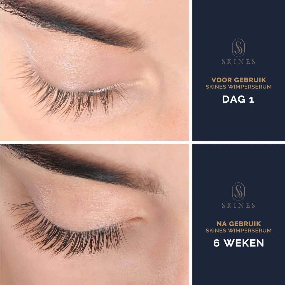 Skines® Wimperserum Premium – Eyelash Serum - Wenkbrauw Serum - Wimper Groei - 3ML 4 Skines® Wimperserum Premium – Eyelash Serum - Wenkbrauw Serum - Wimper Groei - 3ML - Afbeelding 2