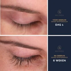 Skines® Wimperserum Premium – Eyelash Serum - Wenkbrauw Serum - Wimper Groei - 3ML 15 Skines® Wimperserum Premium – Eyelash Serum - Wenkbrauw Serum - Wimper Groei - 3ML -Cosmetica Korting Winkel 1200x1200 836