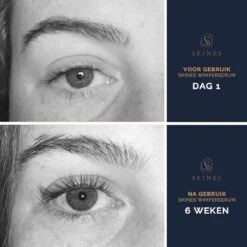 Skines® Wimperserum Premium – Eyelash Serum - Wenkbrauw Serum - Wimper Groei - 3ML 16 Skines® Wimperserum Premium – Eyelash Serum - Wenkbrauw Serum - Wimper Groei - 3ML -Cosmetica Korting Winkel 1200x1200 837