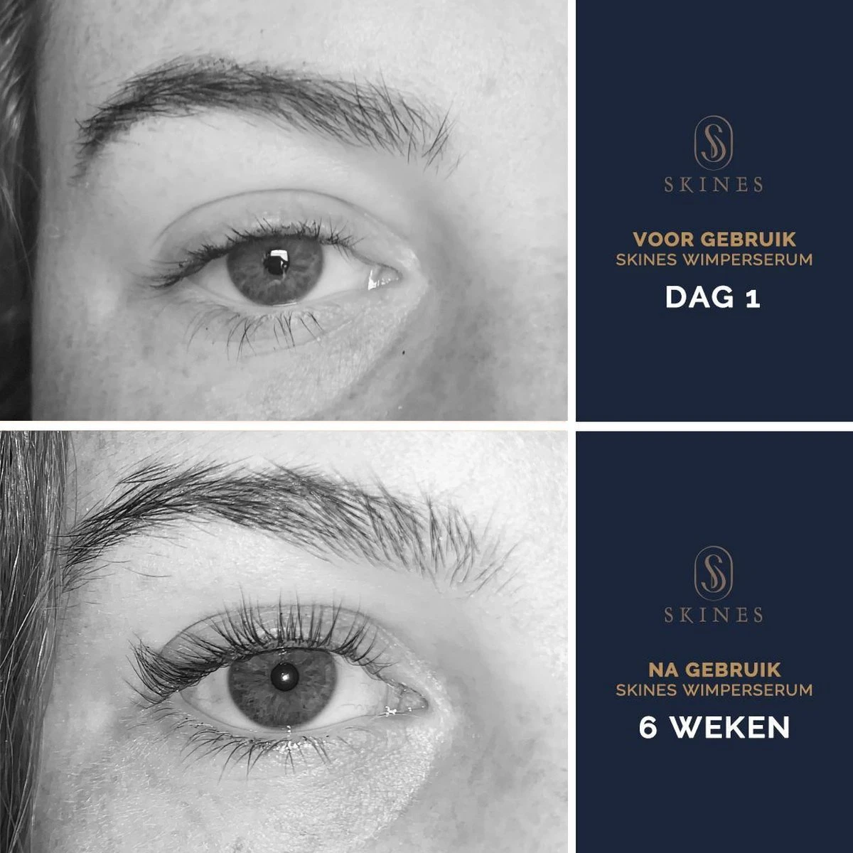 Skines® Wimperserum Premium – Eyelash Serum - Wenkbrauw Serum - Wimper Groei - 3ML 8 Skines® Wimperserum Premium – Eyelash Serum - Wenkbrauw Serum - Wimper Groei - 3ML - Afbeelding 6