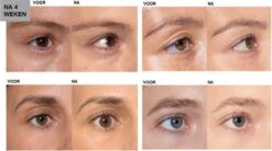 L'Oréal Paris Clinically Proven Wimperserum - 2 Ml -Cosmetica Korting Winkel 1200x670 2