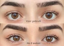 Skines® Wimperserum Premium – Eyelash Serum - Wenkbrauw Serum - Wimper Groei - 3ML 18 Skines® Wimperserum Premium – Eyelash Serum - Wenkbrauw Serum - Wimper Groei - 3ML -Cosmetica Korting Winkel 1200x874
