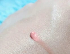 Biodermal Sun Lipbalm SPF25 - Tube 12 Ml - Natural Pink - Lippenbalsem -Cosmetica Korting Winkel 1200x927 2